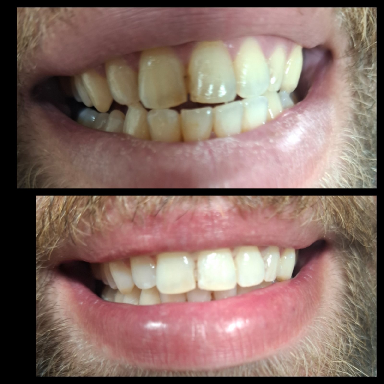 Καθαρισμός και Λεύκανση ιατρείου